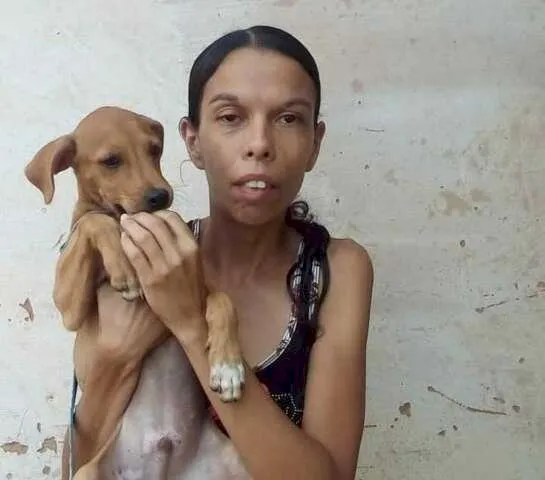 Nova Andradina: Mulher que disse ter sido agredida pelo marido morreu por infecção, aponta laudo