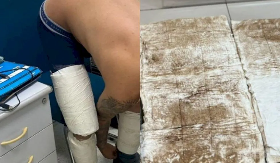 Rapaz é preso ao tentar embarcar em voo com cocaína enrolada nas pernas em aeroporto de MS