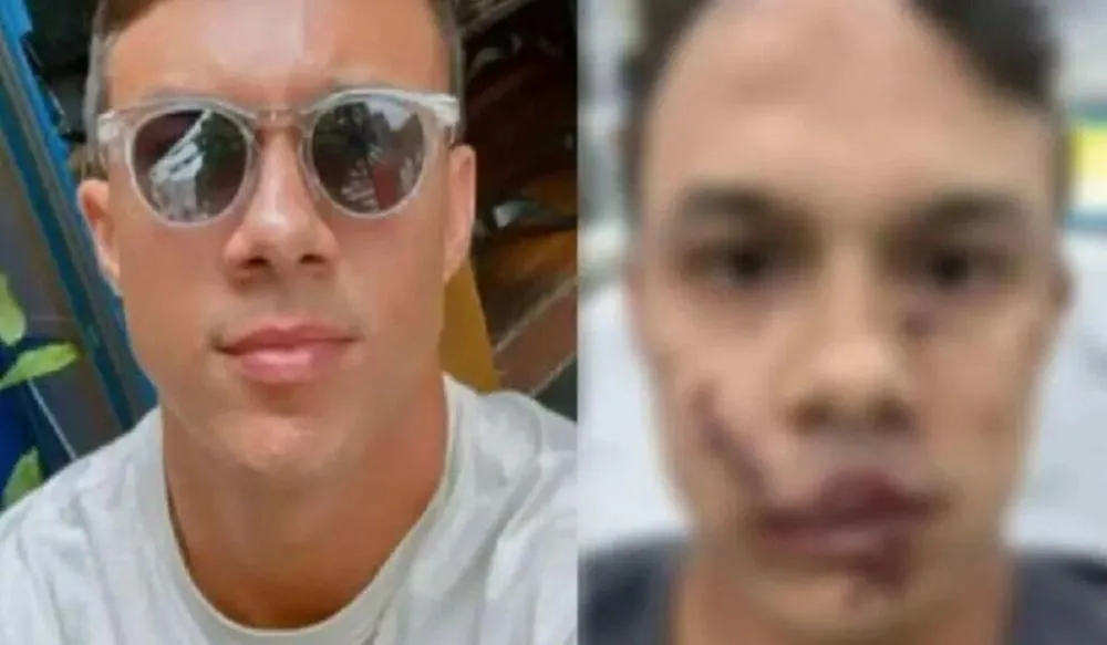 Personal trainer leva 45 pontos no rosto após ser agredido ao defender vítimas de assédio