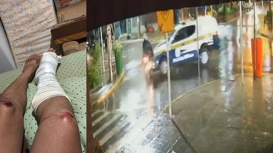 Motociclista fica ferido em batida com viatura da Polícia Militar: 'agiram na maldade' 