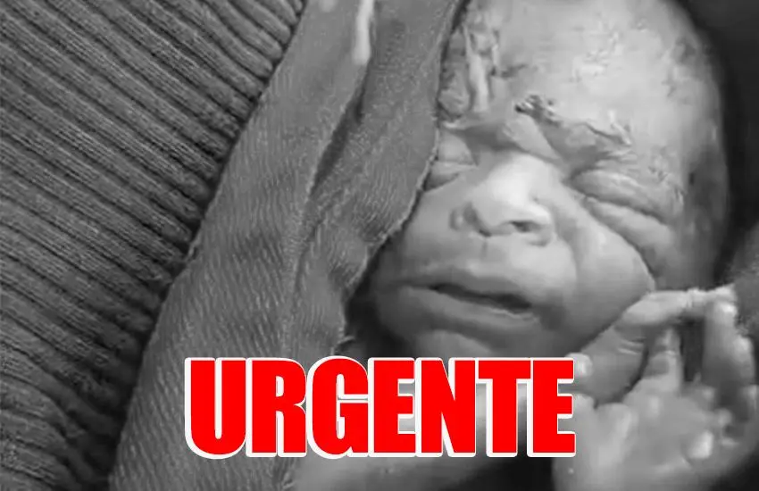 Bebê que “ressuscitou” após ser declarado morto não resiste e falece na UTI de hospital