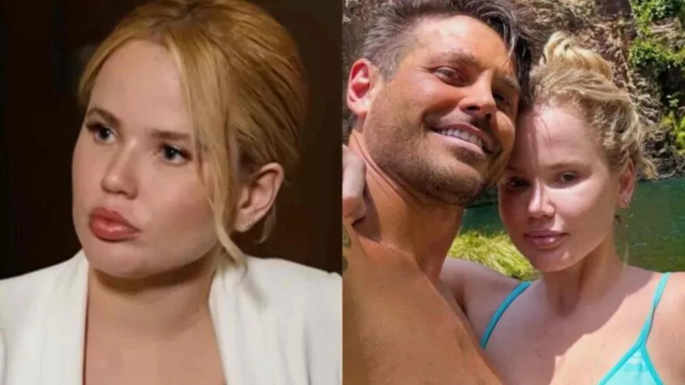 Miss Gramado expõe fotos de agressões que sofreu de Dado Dolabella: ‘Assustada’