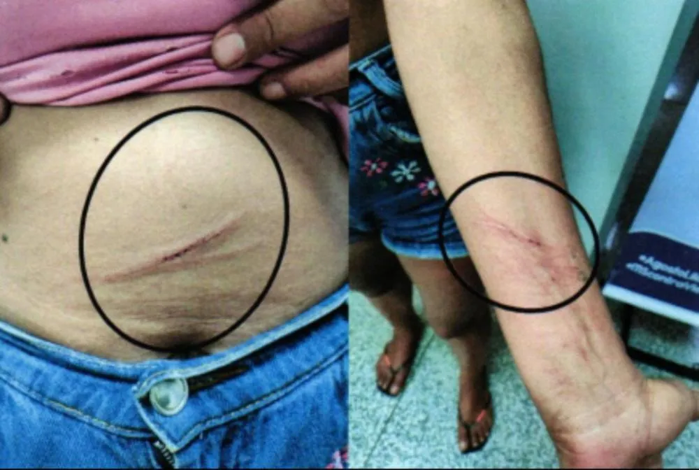 Ex pisoteou rosto de mulher e jogou terra com fezes na boca dela no Danúbio Azul