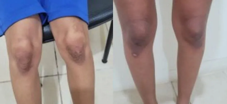 Prisão de mãe e companheira se deu após menor fugir e denunciar tortura em Coxim