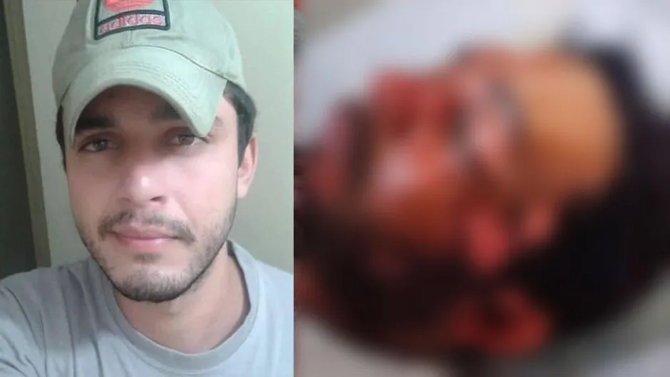 Suspeita de jogar água fervente no ex acumula passagens policiais e seria 'laudada'