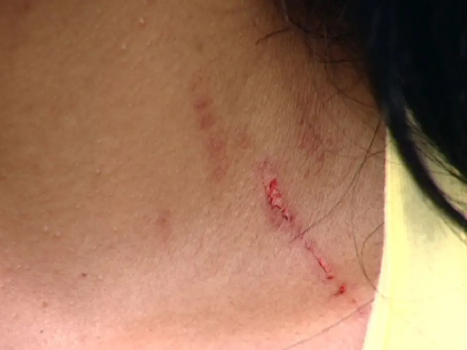 Mulher é agredida pelo amigo do ex-namorado, que acaba preso por tráfico de drogas