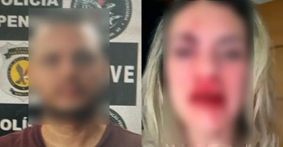 Jornalista agredida por namorado relata medo: 'Estou presa em casa, enquanto ele está solto' 