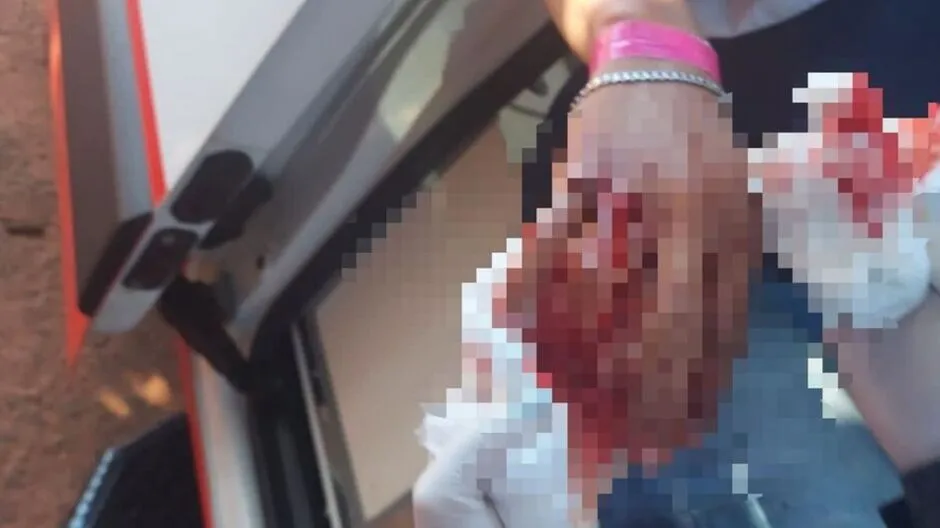 Jovem é socorrido com mão toda ensanguentada ao ser esfaqueado em Aquidauana
